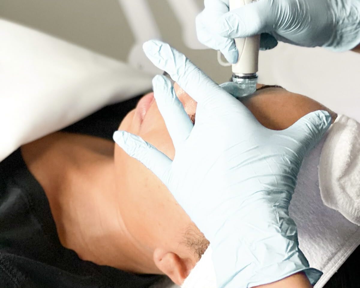 Hydra facial